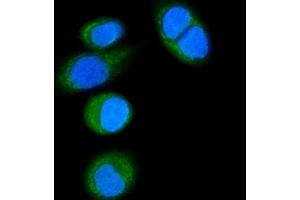 IF analysis of CD14 using anti-CD14 antibody (ABIN7600531).