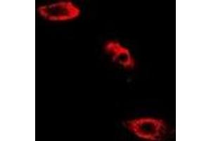 Immunofluorescent analysis of SHMT2 staining in HepG2 cells. (SHMT2 anticorps)