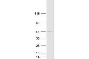 Validation with Western Blot
