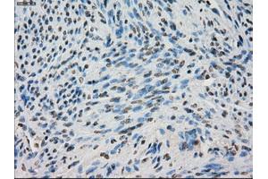 Immunohistochemical staining of paraffin-embedded Ovary tissue using anti-BUB1Bmouse monoclonal antibody. (BUB1B anticorps)