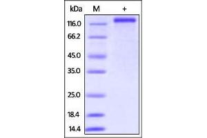 Human CD163, His Tag on SDS-PAGE under reducing (R) condition.