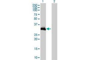 Western Blot analysis of HOXC9 expression in transfected 293T cell line by HOXC9 monoclonal antibody (M01), clone 2B12.
