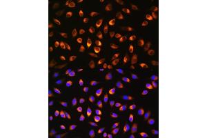 Immunofluorescence analysis of L929 cells using NQO1 Rabbit pAb (ABIN3022059, ABIN3022060, ABIN3022061 and ABIN6218589) at dilution of 1:100.