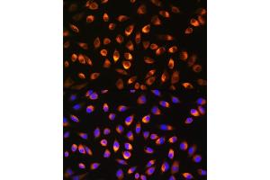 Immunofluorescence analysis of L929 cells using NQO1 Rabbit pAb (ABIN3022059, ABIN3022060, ABIN3022061 and ABIN6218589) at dilution of 1:100. (NQO1 anticorps  (AA 1-50))