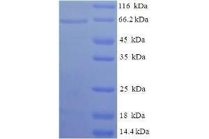 SDS-PAGE (SDS) image for Succinate Dehydrogenase Complex, Subunit D, Integral Membrane Protein (SDHD) (AA 1-440), (full length) protein (His-SUMO Tag) (ABIN5711165)