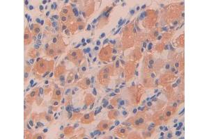 Used in DAB staining on fromalin fixed paraffin- embedded stomach tissue (PTPN9 anticorps  (AA 289-593))