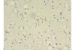 Immunohistochemistry of paraffin-embedded human brain tissue using ABIN7144817 at dilution of 1:100 (ATL3 anticorps  (AA 1-187))