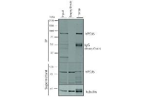 Immunoprecipitation analysis using Mouse Anti-VPS35 Monoclonal Antibody, Clone 11H10 (ABIN6933006).