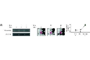 Representative immunoblotting and immunofluorescent analyses for selected differentially expressed proteins identified by proteomic analysis of H9C2 cells in response to doxorubicin treatment and pre-treatment with quercetin. (Vimentin anticorps)