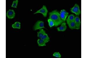 Immunofluorescence staining of MCF-7 cells with ABIN7168912 at 1:133, counter-stained with DAPI. (Hepsin anticorps  (AA 294-413))