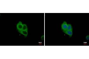 ICC/IF Image NOX1 antibody detects NOX1 protein at cytoplasm by immunofluorescent analysis.