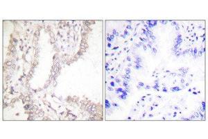 Immunohistochemistry (IHC) image for anti-PRKC, Apoptosis, WT1, Regulator (PAWR) (C-Term) antibody (ABIN1848751) (PAWR anticorps  (C-Term))
