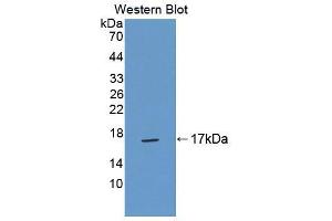 Western blot analysis of the recombinant protein. (TNP2 anticorps  (AA 1-117))
