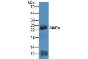 Figure. (MYL4 anticorps  (AA 4-187))