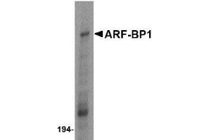 Western blot analysis of ARF-BP1 in Daudi cell lysate with ARF-BP1 antibody at 1 μg/ml. (HUWE1 anticorps  (C-Term))