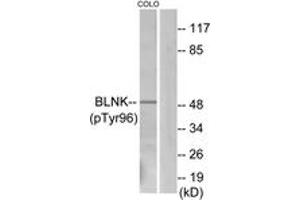 Western blot analysis of extracts from COLO205 cells, using BLNK (Phospho-Tyr96) Antibody. (B-Cell Linker anticorps  (pTyr96))