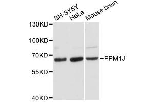 Western blot analysis of extracts of various cell lines, using PPM1J antibody.