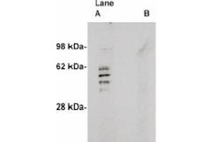 Image no. 1 for anti-Sphingomyelin Synthase 2 (SGMS2) antibody (ABIN4620351) (Sphingomyelin Synthase 2 anticorps)