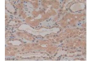 IHC-P analysis of Human Kidney Tissue, with DAB staining. (NUP210 anticorps  (AA 1288-1449))