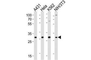 Western blot analysis of lysate from A431, HeLa, K562, mouse NIH3T3 cell line using CDK5 antibody (CDK5 anticorps  (AA 254-289))