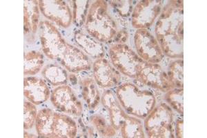 DAB staining on IHC-P; Samples: Human Kidney Tissue (IL12A anticorps  (AA 23-219))