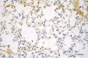 Immunohistochemistry was performed on paraffin-embedded mouse lung using pannexin 1 antibody (ABIN7799733), 1:200). (Recombinant PANX1 anticorps)