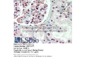 Immunohistochemistry (IHC) image for anti-T-Box 20 (TBX20) (N-Term) antibody (ABIN2777791)