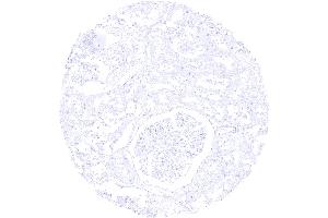 Kidney cortex S100P immunostaining is completely lacking in the kidney