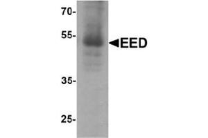 Western blot analysis of EED in human heart tissue lysate with EED Antibody  at 1 μg/ml. (EED anticorps  (N-Term))