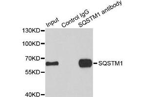 Immunoprecipitation analysis of 100 μg extracts of HepG2 cells using 3 μg SQSTM1 antibody (ABIN5998960). (SQSTM1 anticorps)