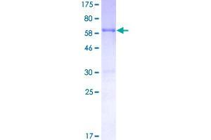 Image no. 1 for Retinitis Pigmentosa 2 (X-Linked Recessive) (RP2) (AA 1-350) protein (GST tag) (ABIN1318478)
