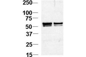 Western Blotting (WB) image for anti-Nucleosome Assembly Protein 1-Like 1 (NAP1L1) antibody (ABIN3000776)