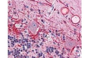 Immunohistochemistry of Mouse anti-AKT pT308 antibody. (AKT1 anticorps  (pThr308))