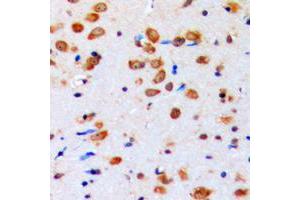 Immunohistochemical analysis of AKT (pY315) staining in human brain formalin fixed paraffin embedded tissue section. (AKT1 anticorps  (pTyr315))