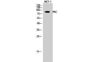 Western Blotting (WB) image for anti-Protein Kinase C (pan) (PKC pan) (Lys246) antibody (ABIN3186464)