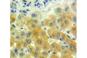 IHC-P analysis of Liver tissue, with DAB staining. (GDF7 anticorps  (AA 295-447))