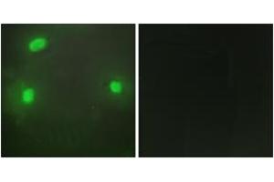 Immunofluorescence analysis of HeLa cells, using FEN1 Antibody. (FEN1 anticorps  (AA 86-135))