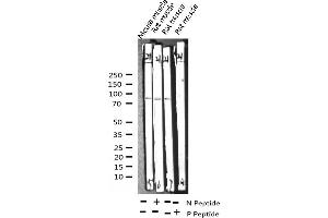Western blot analysis of Phospho-Caldesmon (Ser789) expression in various lysates