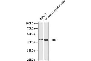 Western blot analysis of extracts of various cell lines, using FIBP antibody  at 1:1000 dilution. (FIBP anticorps  (AA 1-364))