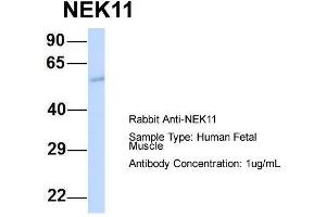 Host:  Rabbit  Target Name:  NEK11  Sample Type:  Human Fetal Muscle  Antibody Dilution:  1.