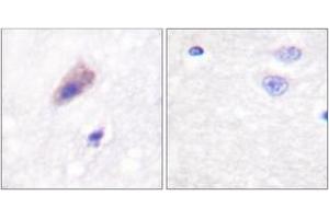 Immunohistochemistry analysis of paraffin-embedded human brain, using Dynamin-1 (Phospho-Ser774) Antibody. (Dynamin 1 anticorps  (pSer774))