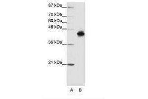 Image no. 1 for anti-Keratin 18 (KRT18) (N-Term) antibody (ABIN203131) (Cytokeratin 18 anticorps  (N-Term))