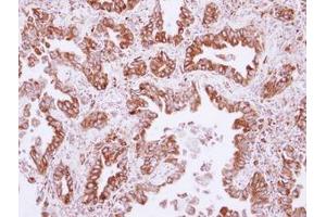 anti-NudC Domain Containing 1 (NUDCD1) (AA 332-583) antibody