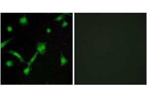 Immunofluorescence analysis of LOVO cells, using IkappaB-alpha (Phospho-Ser32/Ser36) Antibody. (NFKBIA anticorps  (pSer32))