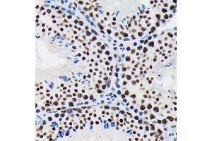 Immunohistochemistry of paraffin-embedded mouse testis using SF3B1 Rabbit mAb (ABIN7270542) at dilution of 1:100 (40x lens).