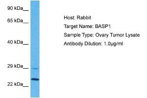 Host: Rabbit Target Name: BASP1 Sample Tissue: Human Ovary Tumor Antibody Dilution: 1ug/ml (BASP1 anticorps  (N-Term))