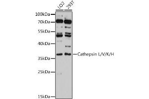 Western blot analysis of extracts of various cell lines, using Cathepsin L/V/K/H antibody (ABIN6127670, ABIN6139235, ABIN6139237 and ABIN6215636) at 1:3000 dilution. (Cathepsin L anticorps  (AA 114-333))
