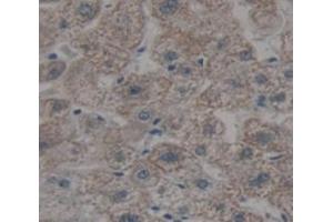 IHC-P analysis of Human Tissue, with DAB staining. (SEMA4D/CD100 anticorps  (AA 502-636))