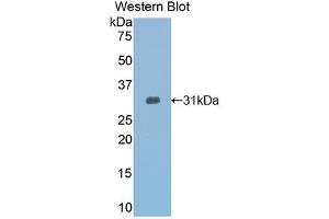 Western blot analysis of recombinant Mouse TOLLIP. (TOLLIP anticorps  (AA 19-254))