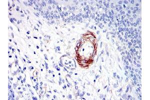 Immunohistochemical analysis of paraffin-embedded human esophagus tissues using GKAP mouse mAb with DAB staining.
